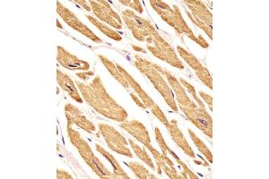 Antibody staining VLDLR in human heart tissue sections by Immunohistochemistry (IHC-P - paraformaldehyde-fixed, paraffin-embedded sections). (Very Low Density Lipoprotein (VLDL) (AA 484-510) 抗体)