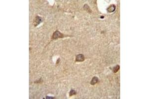 Formalin fixed and paraffin embedded human brain tissue reacted with CD39L3 / ENTPD3 Antibody (C-term) followed by peroxidase conjugation of the secondary antibody and DAB staining. (ENTPD3 抗体  (C-Term))