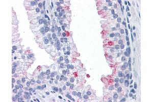 Anti-RTKN antibody IHC of human prostate. (Rhotekin 抗体  (AA 451-550))