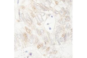 Immunohistochemistry (IHC) image for anti-Adenomatous Polyposis Coli (APC) (C-Term) antibody (ABIN7454385)