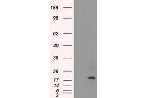 HEK293T cells were transfected with the pCMV6-ENTRY control (Left lane) or pCMV6-ENTRY CRYAB (Right lane) cDNA for 48 hrs and lysed. (CRYAB 抗体)