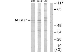 Western blot analysis of extracts from 293 cells, HepG2 cells and Jurkat cells, using ACRBP antibody. (ACRBP 抗体  (Internal Region))