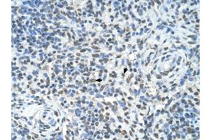 ZMYND11 antibody was used for immunohistochemistry at a concentration of 4-8 ug/ml to stain Spleen cells (arrows) in Human Spleen. (ZMYND11 抗体  (Middle Region))