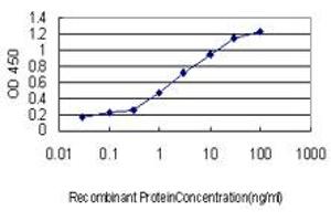 Detection limit for recombinant GST tagged RBBP6 is approximately 0. (RBBP6 抗体  (AA 1582-1691))