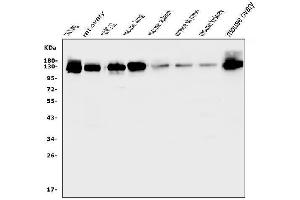 Western blot analysis of MCAM using anti-MCAM antibody (ABIN7601026). (MCAM 抗体  (AA 27-621))