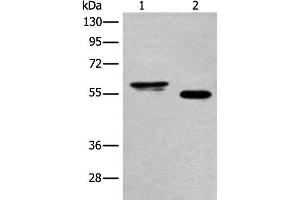 Western blot analysis of Human cervical cancer tissue and A549 cell lysates using HAS3 Polyclonal Antibody at dilution of 1:400 (HAS3 抗体)