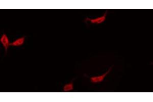 ABIN6267466 staining HeLa by IF/ICC.