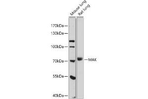 Western blot analysis of extracts of various cell lines, using MAK antibody (ABIN7268382) at 1:1000 dilution. (MAK 抗体  (AA 370-435))