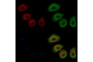 ABIN7094071 and ABIN7098115 staining Hela cells by IF/ICC. (ARHGAP10 抗体  (Internal Region))