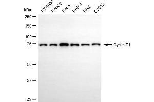 anti-Cyclin T1 (CCNT1) antibody