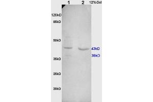 L1 rat kidney, L2 human colon carcinoma lysates probed (ABIN732098) at 1:200 in 4 °C. (Cathepsin D 抗体  (AA 101-200))