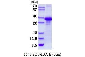 Chloride Channel, Nucleotide-Sensitive, 1A (CLNS1A) protein (His tag)