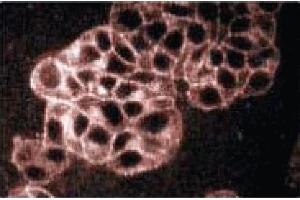 Immunofluoresence staining of PC12 cells (rat neuroblastoma, ATCC CRL 1721). (Synaptophysin 抗体  (AA 205-306))