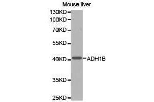 Western Blotting (WB) image for anti-Alcohol Dehydrogenase 1B (Class I), beta Polypeptide (ADH1B) antibody (ABIN1870818) (ADH1B 抗体)