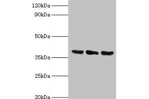 Western blot All lanes: TMOD3 antibody at 5 μg/mL Lane 1: Jurkat whole cell lysate Lane 2: MCF-7 whole cell lysate Lane 3: Hela whole cell lysate Secondary Goat polyclonal to rabbit IgG at 1/10000 dilution Predicted band size: 40 kDa Observed band size: 40 kDa (TMOD3 抗体  (AA 1-352))