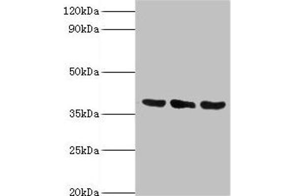 TMOD3 anticorps  (AA 1-352)