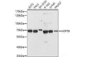 Western blot analysis of extracts of various cell lines using NOP58 Polyclonal Antibody at dilution of 1:1000. (NOP58 抗体)