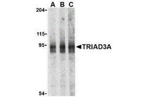Western Blotting (WB) image for anti-Ring Finger Protein 216 (RNF216) (N-Term) antibody (ABIN2476944) (RNF216 抗体  (N-Term))