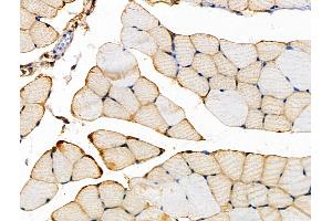 ABIN6262613 and ABIN6266565 at 1/100 staining Mouse muscle tissue by IHC-P. (Integrin beta 5 抗体  (C-Term))