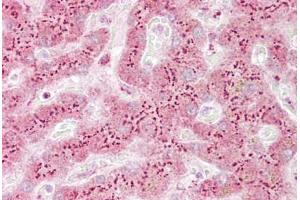 Anti-TGOLN2 / TGN46 antibody IHC staining of human liver. (TGOLN2 抗体  (AA 35-84))