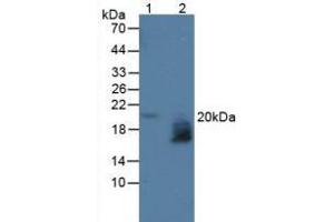 Figure. (WFDC2 抗体  (AA 30-124))