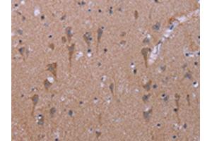 The image on the left is immunohistochemistry of paraffin-embedded Human brain tissue using ABIN7191187(KCNJ9 Antibody) at dilution 1/30, on the right is treated with synthetic peptide. (KCNJ9 抗体)
