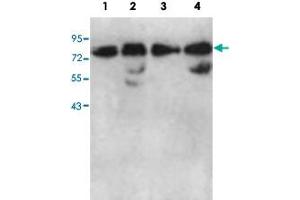 Western blot analysis of HeLa cell (Lane 1), human fetal kidney (Lane 2), K-562 cell (Lane 3) and fetal lung (Lane 4) lysate with AARSD1 polyclonal antibody  at 1 : 1000 dilution. (AARSD1 抗体  (AA 278-522))