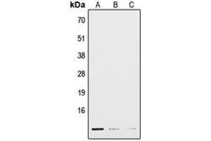 Western blot analysis of POLR3K expression in HepG2 (A), mouse lung (B), H9C2 (C) whole cell lysates.