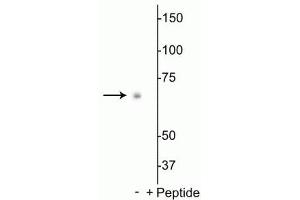 Western blot of Drosophila S2 cell lysate showing specific labeling of the ~70 kDa p70 S6K protein phosphorylated at Thr398 in the first lane (-). (RPS6KB1 抗体  (pThr398))
