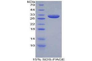 SDS-PAGE analysis of Rabbit Apolipoprotein A1 Protein. (APOA1 蛋白)