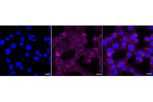 anti-MAP/microtubule Affinity-Regulating Kinase 2 (MARK2) antibody