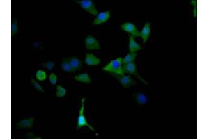 Immunofluorescence staining of HepG2 Cells with ABIN7127627 at 1:50, counter-stained with DAPI. (Recombinant Monoamine Oxidase A 抗体)