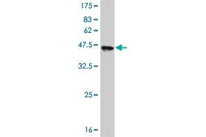 Western Blot detection against Immunogen (41. (ASK1 抗体  (AA 1231-1374))