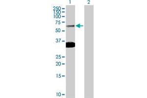 Western Blot analysis of SMAD6 expression in transfected 293T cell line by SMAD6 MaxPab polyclonal antibody. (SMAD6 抗体  (AA 1-496))