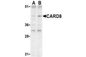Western blot analysis of CARD8 expression in K562 cell lysate with AP30184PU-N CARD8 antibody at (A) 2 and (B) 4 μg /ml. (CARD8 抗体)