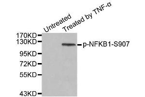 Western blot analysis of extract from HeLa cells, using phospho-NFKB1-S907 antibody (ABIN2988208). (NFKB1 抗体  (pSer907))