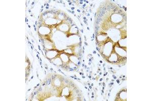 Immunohistochemistry of paraffin-embedded human colon using PRKCA antibody. (PKC alpha 抗体  (C-Term))