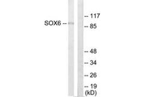 Western blot analysis of extracts from Jurkat cells, using SOX6 Antibody. (SOX6 抗体  (AA 10-59))