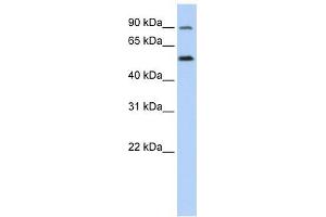 SLC41A1 antibody used at 1 ug/ml to detect target protein. (SLC41A1 抗体  (N-Term))