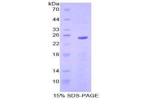 SDS-PAGE (SDS) image for Sprouty Homolog 2 (SPRY2) (AA 116-305) protein (His tag) (ABIN1879200)