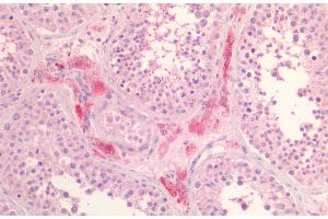 Staining of paraffin embedded Human Testis. (SCARB1 抗体  (AA 238-250))