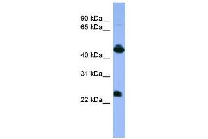 WB Suggested Anti-OPN1MW Antibody Titration: 0. (OPN1MW 抗体  (C-Term))