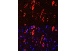 Immunofluorescence (IF) image for anti-Neurotrophic tyrosine Kinase, Receptor, Type 3 (NTRK3) (AA 40-300) antibody (ABIN6144910)