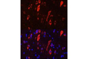 Immunofluorescence analysis of rat brain cells using NTRK3 Rabbit pAb (ABIN6132429, ABIN6144910, ABIN6144912 and ABIN6221540) at dilution of 1:100 (40x lens).