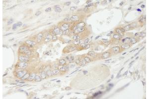 Immunohistochemistry (IHC) image for anti-Eukaryotic Translation Elongation Factor 1 gamma (EEF1G) (AA 200-250) antibody (ABIN7448955)