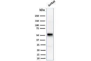 Western Blot Analysis of human Jurkat cell lysate using Cyclin E Mouse Monoclonal Antibody (CCNE1/2460). (Cyclin E1 抗体  (AA 10-176))