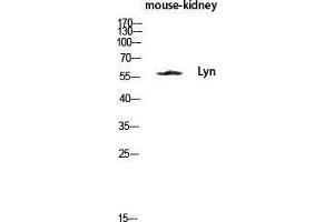 Western Blot (WB) analysis of Mouse Kidney lysis using Lyn antibody. (LYN 抗体  (Ser78))
