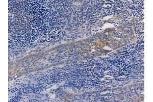 ABIN6256169 and ABIN6267274 at 1/100 staining human normal tonsil tissue by IHC-P. (Estrogen Receptor alpha 抗体  (pSer167))
