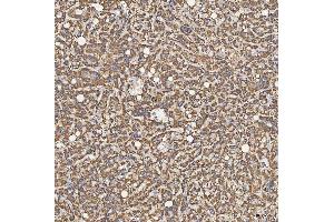 IHC analysis of SFXN5 using anti-SFXN5 antibody (ABIN7601388). (Sideroflexin 5 抗体  (AA 34-340))