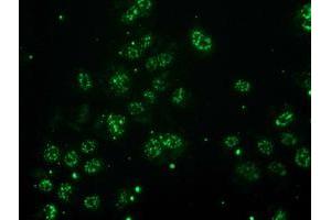 Anti-MGLL mouse monoclonal antibody (ABIN2454561) immunofluorescent staining of COS7 cells transiently transfected by pCMV6-ENTRY MGLL (RC218358). (MGLL 抗体)